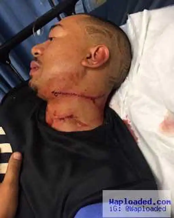 Man shares story of how he was beaten up while trying to help some girls from being assaulted - PHOTO